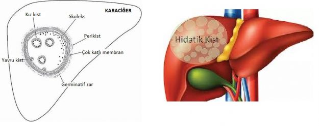 kist