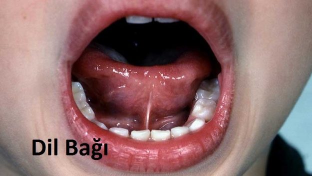 dilbagi